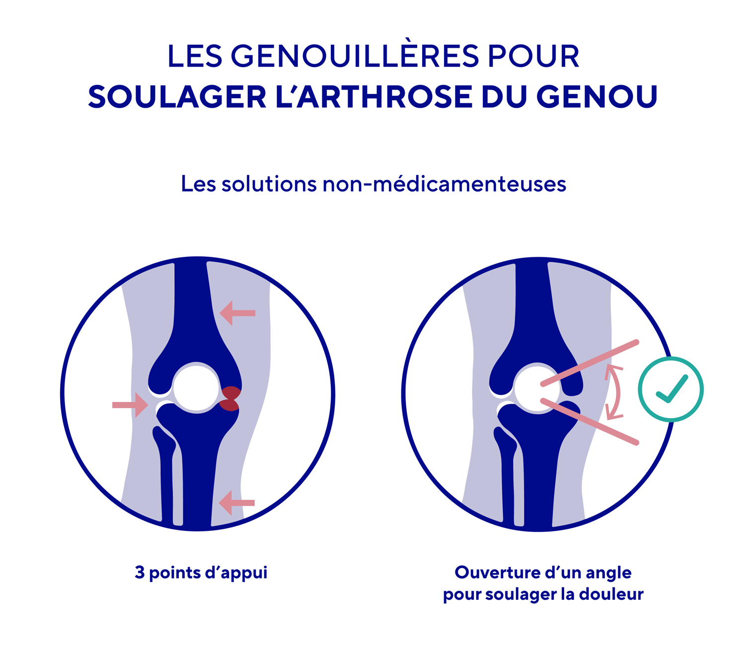 Des genouillères pour soulager l'arthrose du genou | Thuasne (FR)